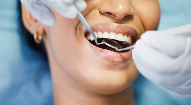 Best Emergency Broken Tooth Repair in Bright, IN