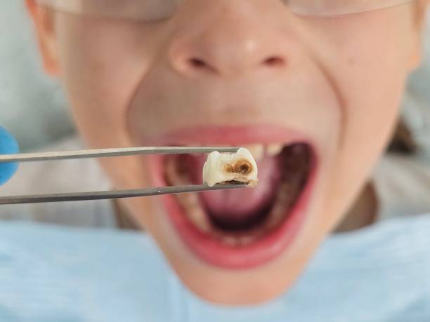 Best Emergency Orthodontic Repairs in Bright, IN